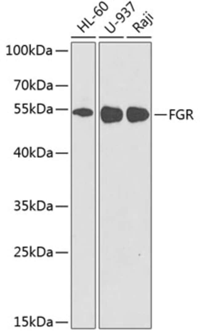 100UL FGR ANTIBODY 100 ul