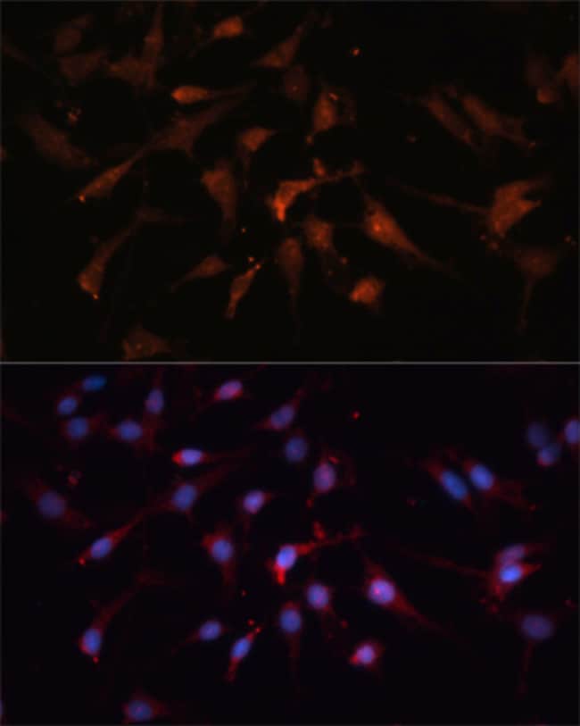 100UL GSK3B ANTIBODY 100 ul