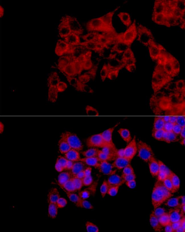 100UL IL1RA ANTIBODY 100 ul