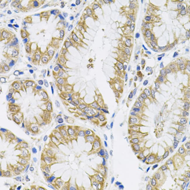 100UL IL-13 ANTIBODY 100 ul