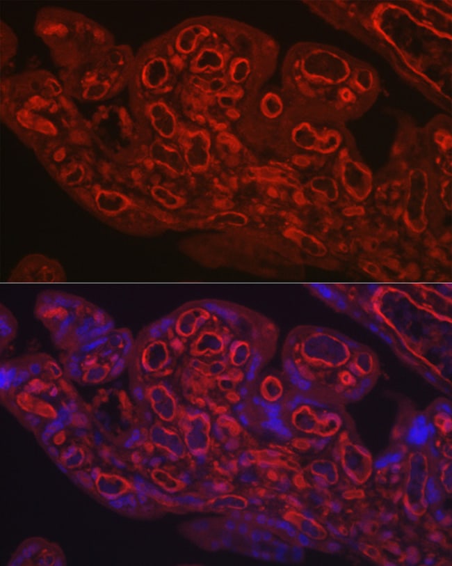 100UL CD31 ANTIBODY 100 ul