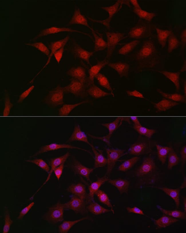 100UL LKB1 ANTIBODY 100 ul