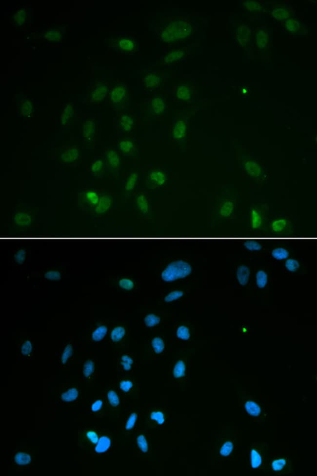 100UL CHK2 ANTIBODY 100 ul