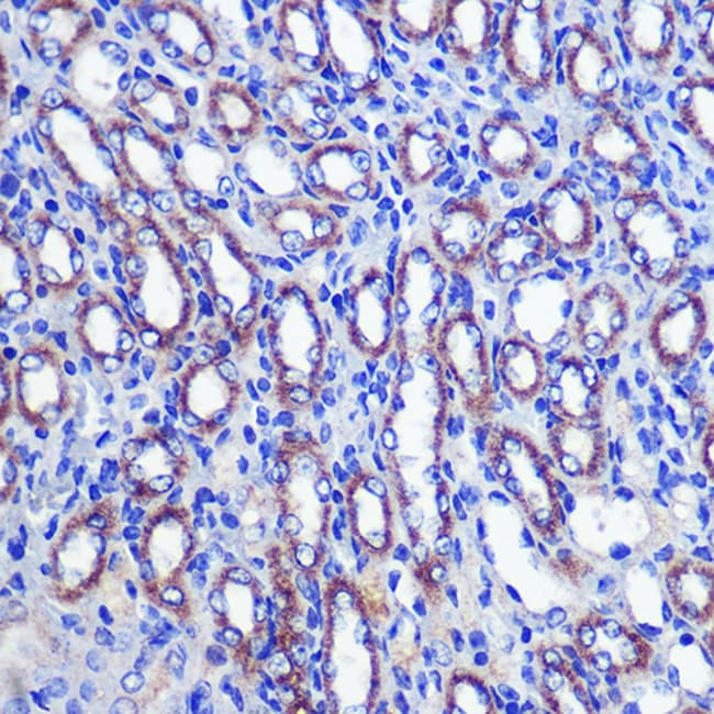 100UL LETMD1 ANTIBODY 100 ul