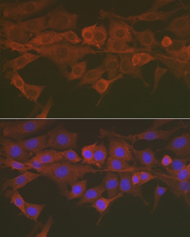 100UL CASPASE 3 ANTIBODY 100 ul