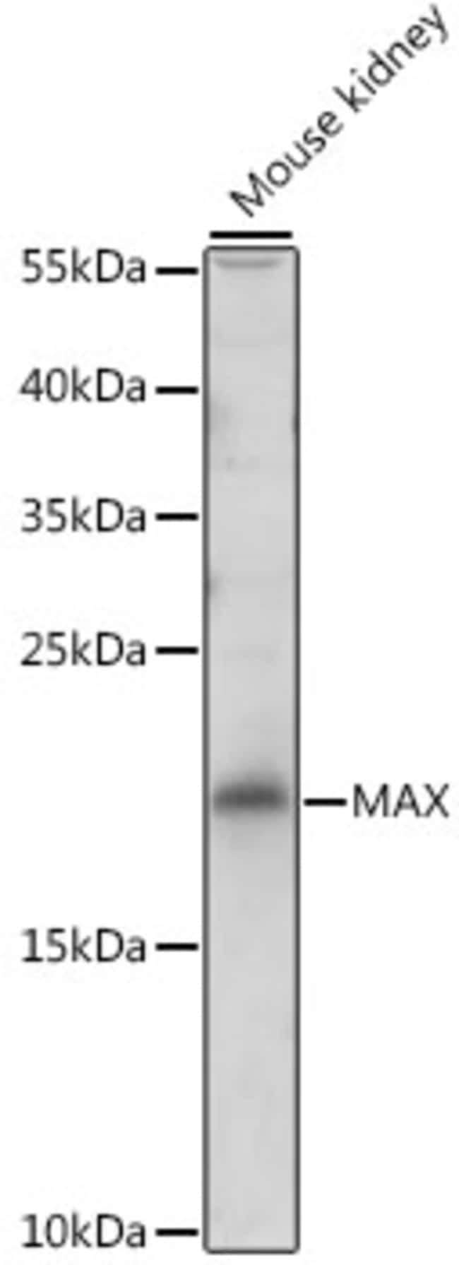 100UL MAX ANTIBODY 100 ul