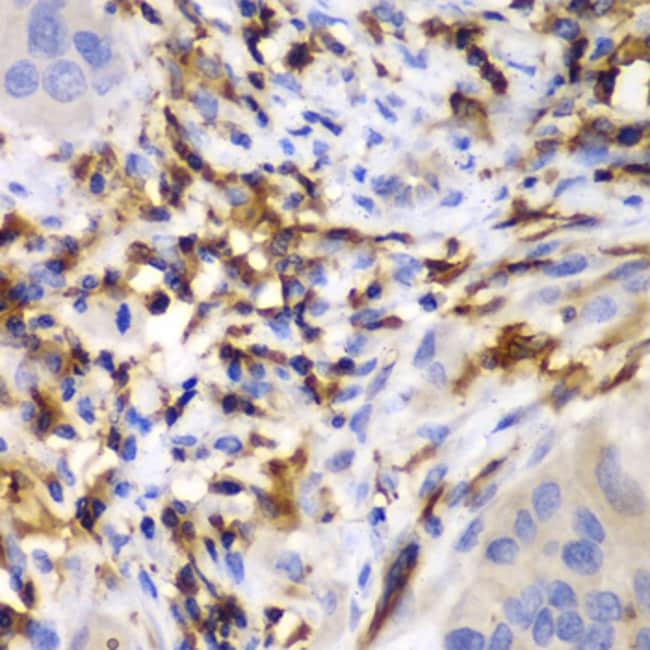 100UL HCLS1 ANTIBODY 100 ul