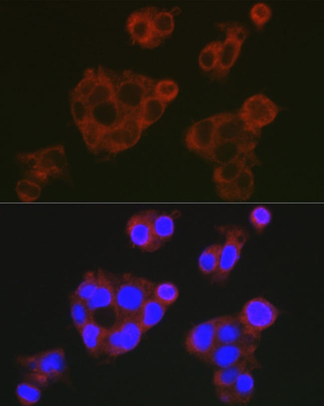 100UL COMPLEMENT FACTOR H ANTIBODY 100 u