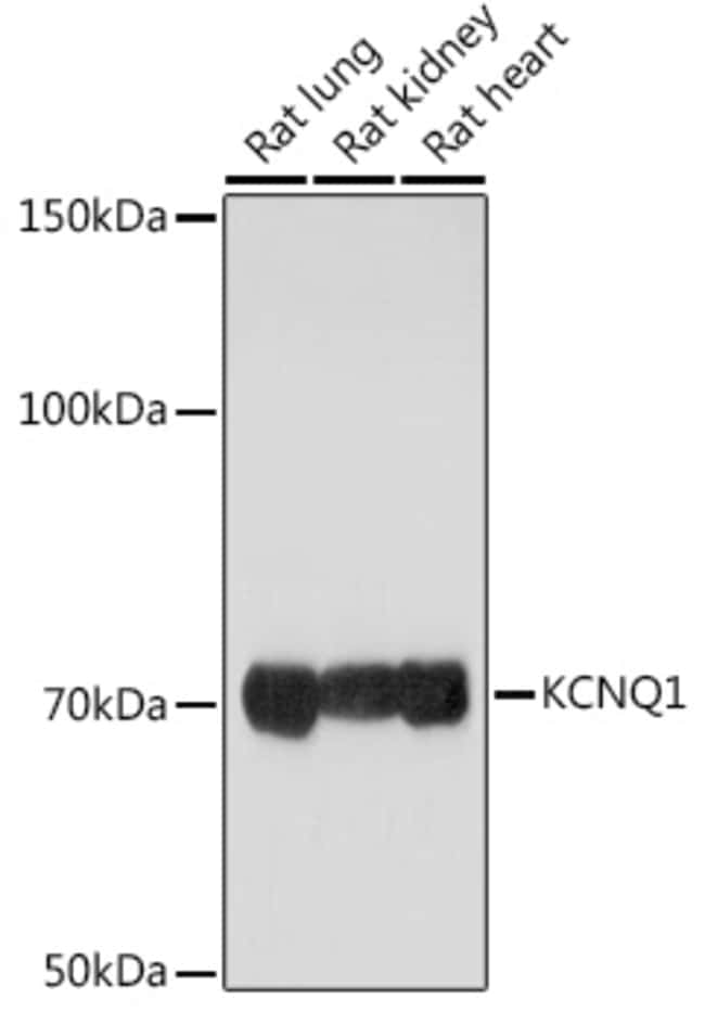 100UL KCNQ1 ANTIBODY 100 ul