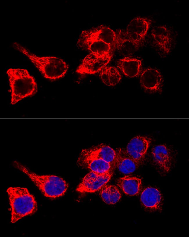 100UL CYTOKERATIN 17 ANTIBODY 100 ul