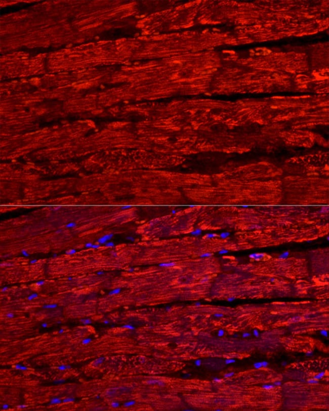 100UL BNP ANTIBODY 100 ul