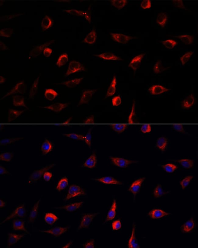 100UL MEK7 ANTIBODY 100 ul
