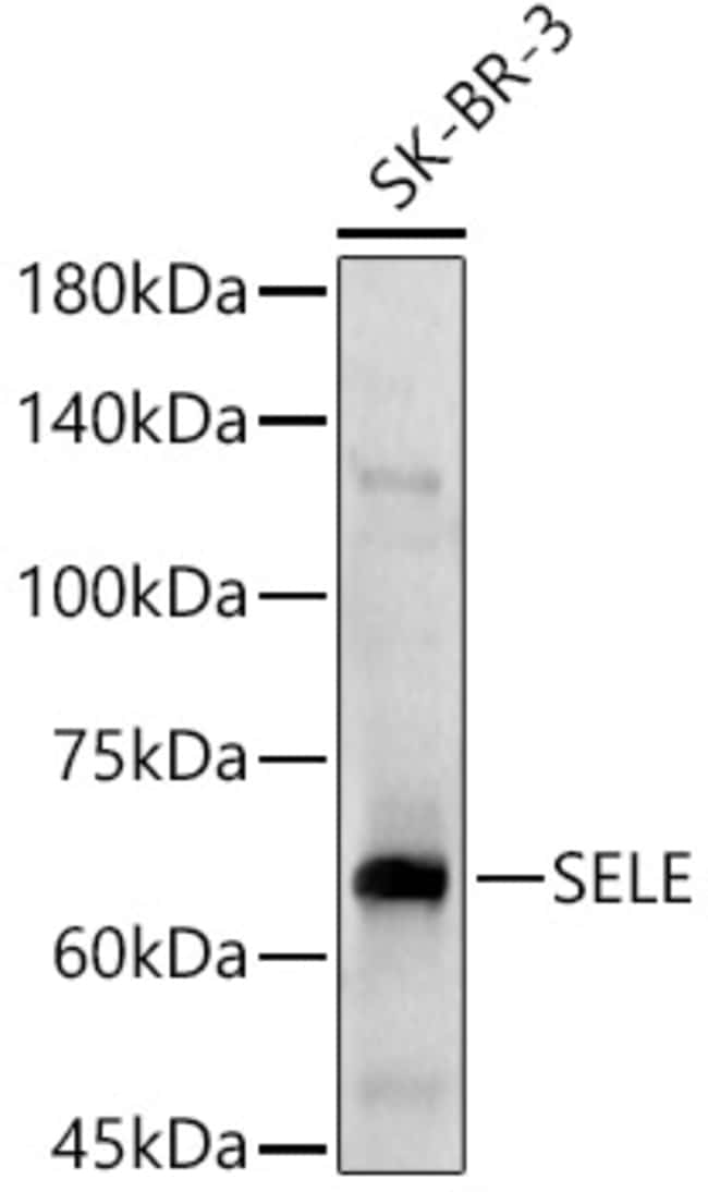 100UL CD62E (E-SELECTIN) ANTIBODY 100 ul