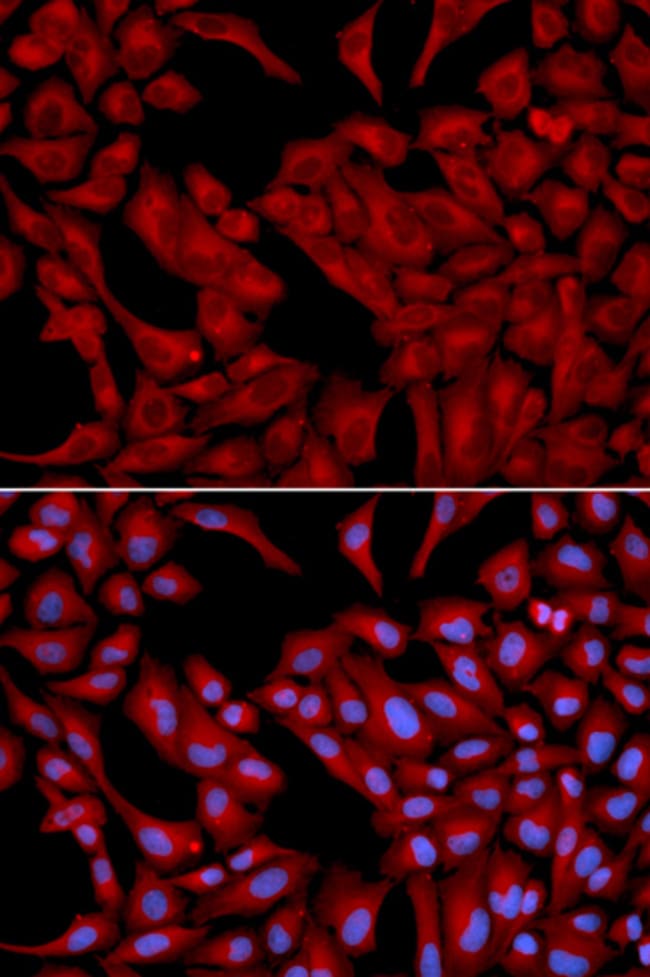 100UL DYNACTIN 2 ANTIBODY 100 ul