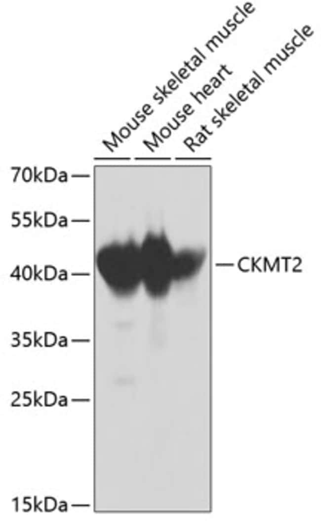 100UL CKMT2 ANTIBODY 100 ul