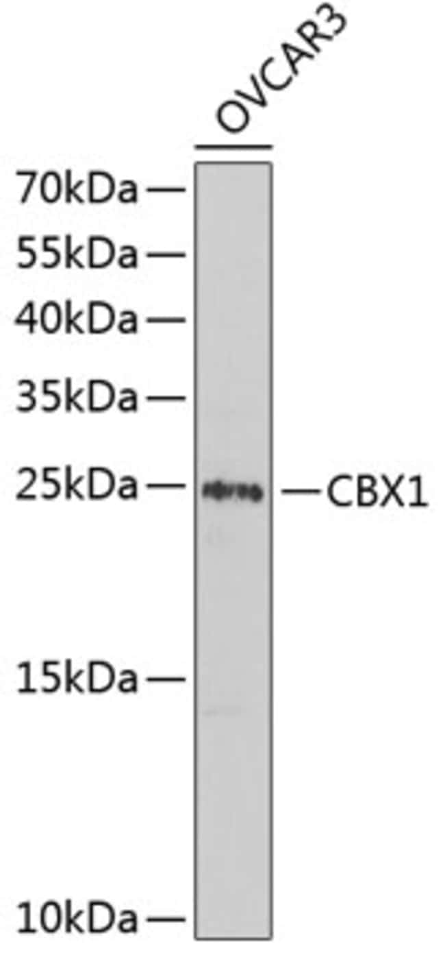 100UL HP1 BETA ANTIBODY 100 ul