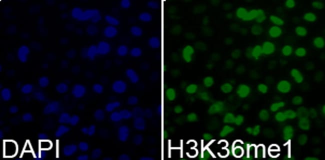 100UL METHYL-HISTONE H3 (LYS36) ANTI 100