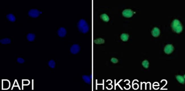 100UL DI-METHYL-HISTONE H3 (LYS36) A 100