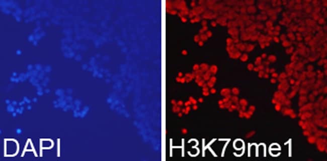 100UL METHYL-HISTONE H3 (LYS79) ANTI 100