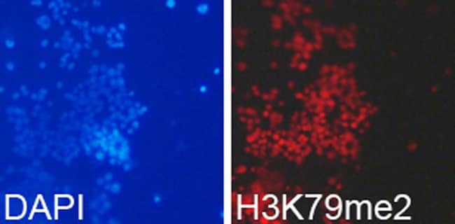 100UL DI-METHYL-HISTONE H3 (LYS79) A 100
