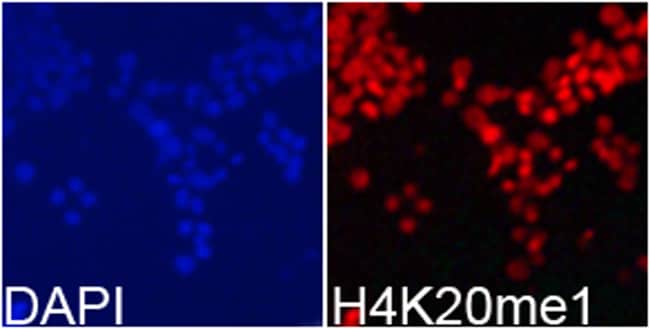 100UL METHYL-HISTONE H4 (LYS20) ANTI 100