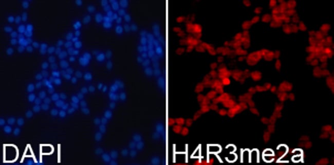 100UL DI-METHYL-HISTONE H4 (ARG3) AN 100