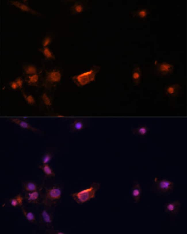 100UL BRCA2 ANTIBODY 100 ul