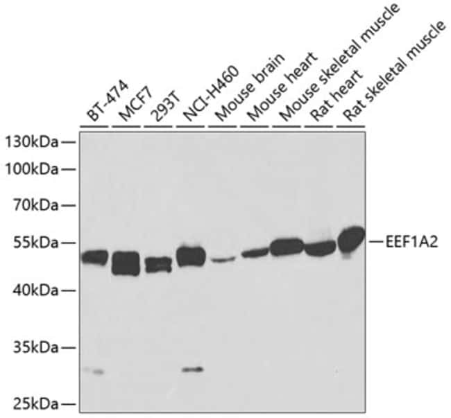 100UL EEF1A2 ANTIBODY 100 ul