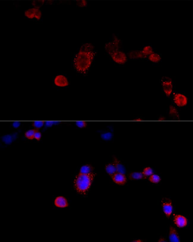 100UL FILAMIN B ANTIBODY 100 ul
