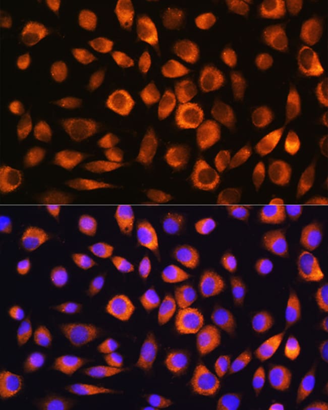 100UL HSC70 ANTIBODY 100 ul