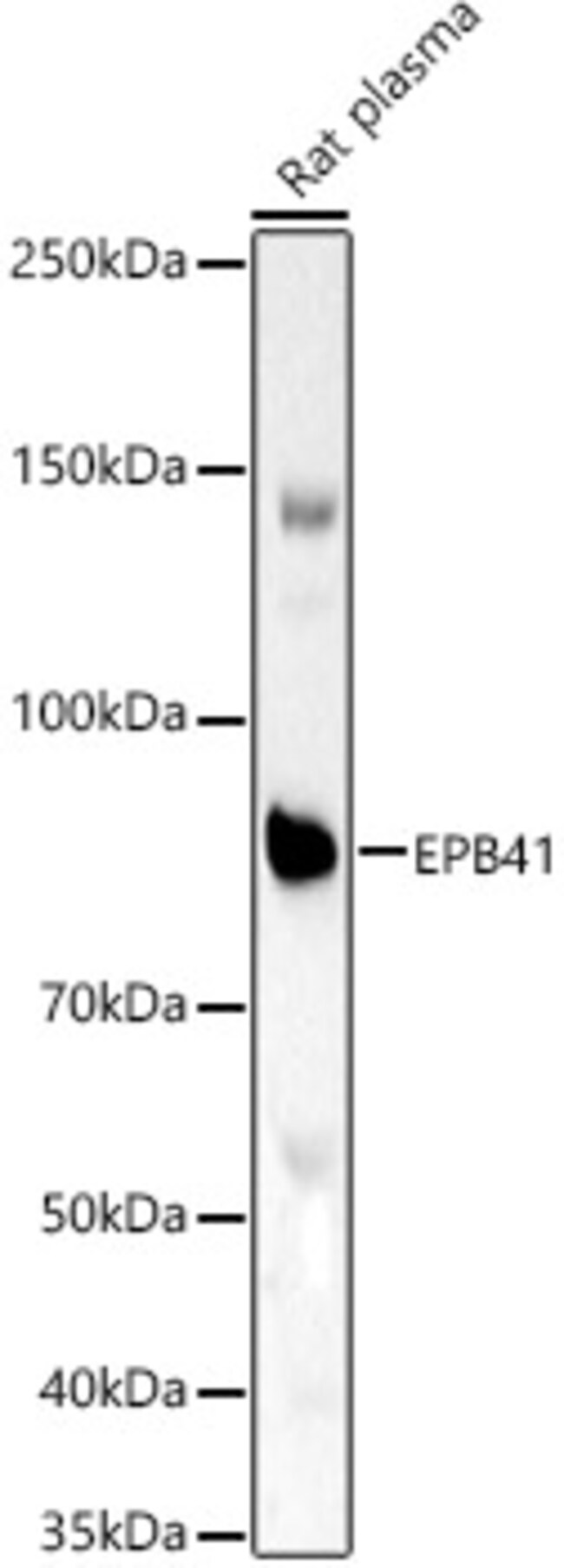 100UL EPB41 ANTIBODY 100 ul