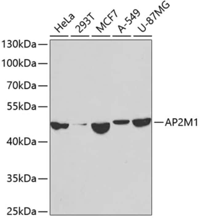 100UL AP2M1 ANTIBODY 100 ul