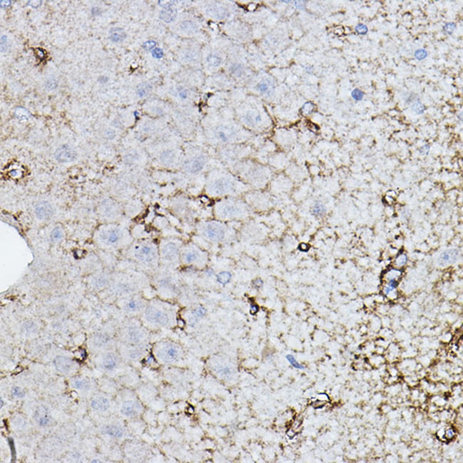 100UL CHAT ANTIBODY 100 ul