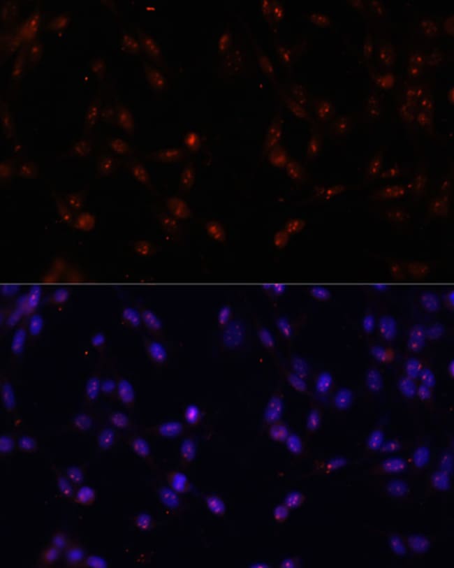 100UL ILF3 ANTIBODY 100 ul