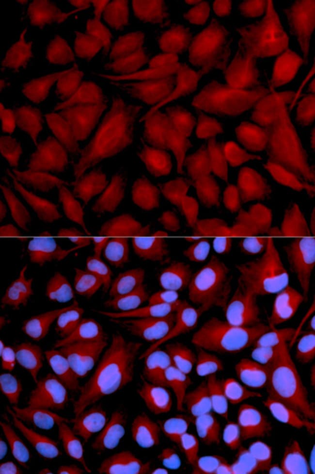 100UL CASK ANTIBODY 100 ul