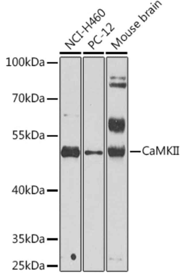 100UL CAMKII BETA ANTIBODY 100 ul