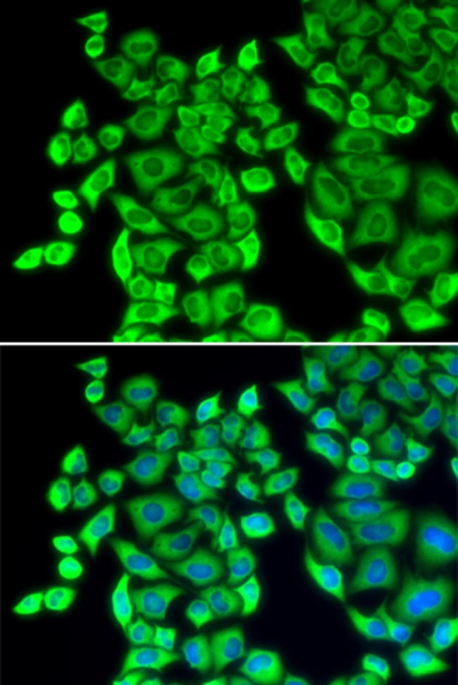 100UL EEF1D ANTIBODY 100 ul