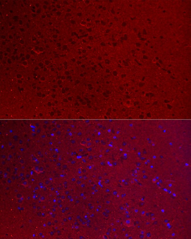 100UL GNAO1 ANTIBODY 100 ul