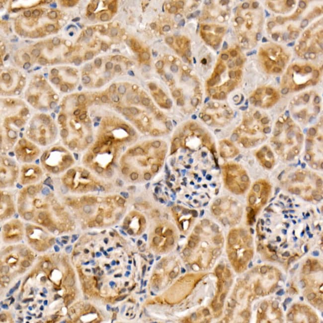 100UL ACK1 ANTIBODY 100 ul
