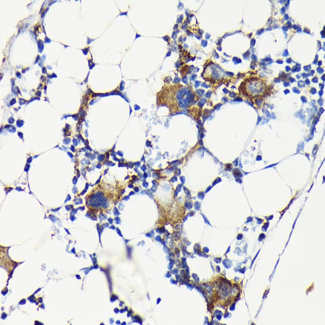 100UL CD61 ANTIBODY 100 ul