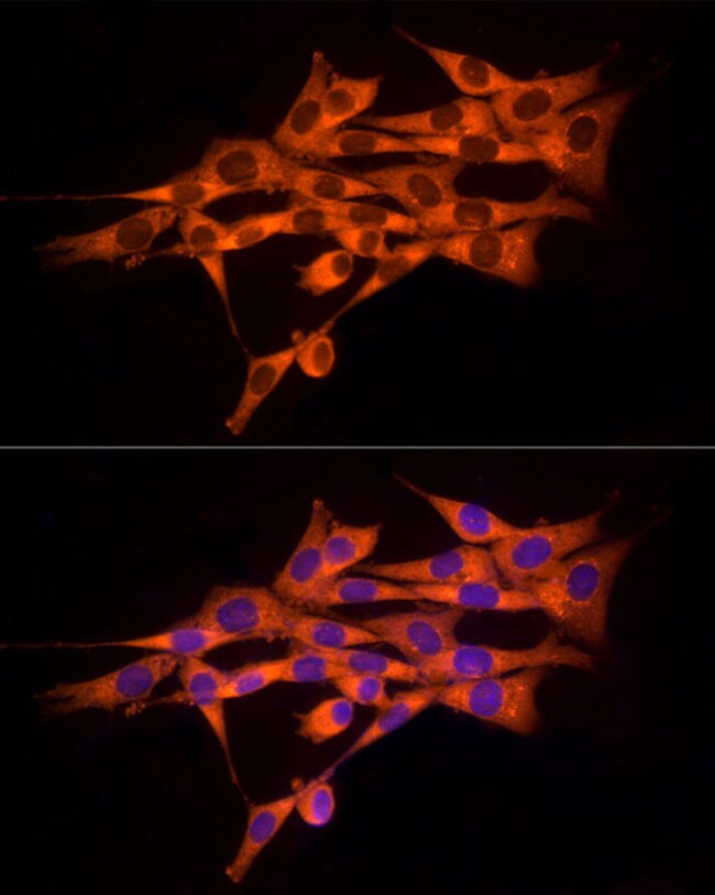 100UL MMP14 ANTIBODY 100 ul