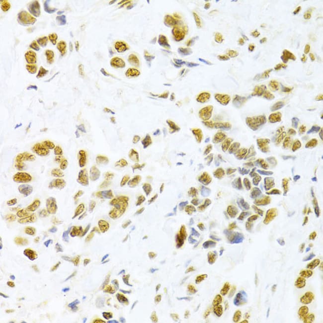 100UL HMGB1 ANTIBODY 100 ul