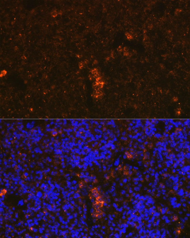 100UL GRANZYME B ANTIBODY 100 ul