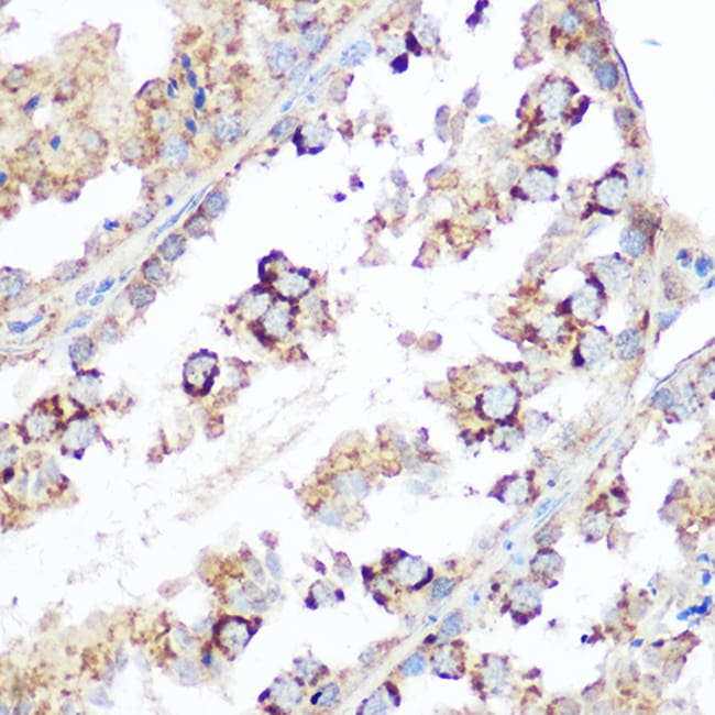 100UL DIABLO ANTIBODY 100 ul