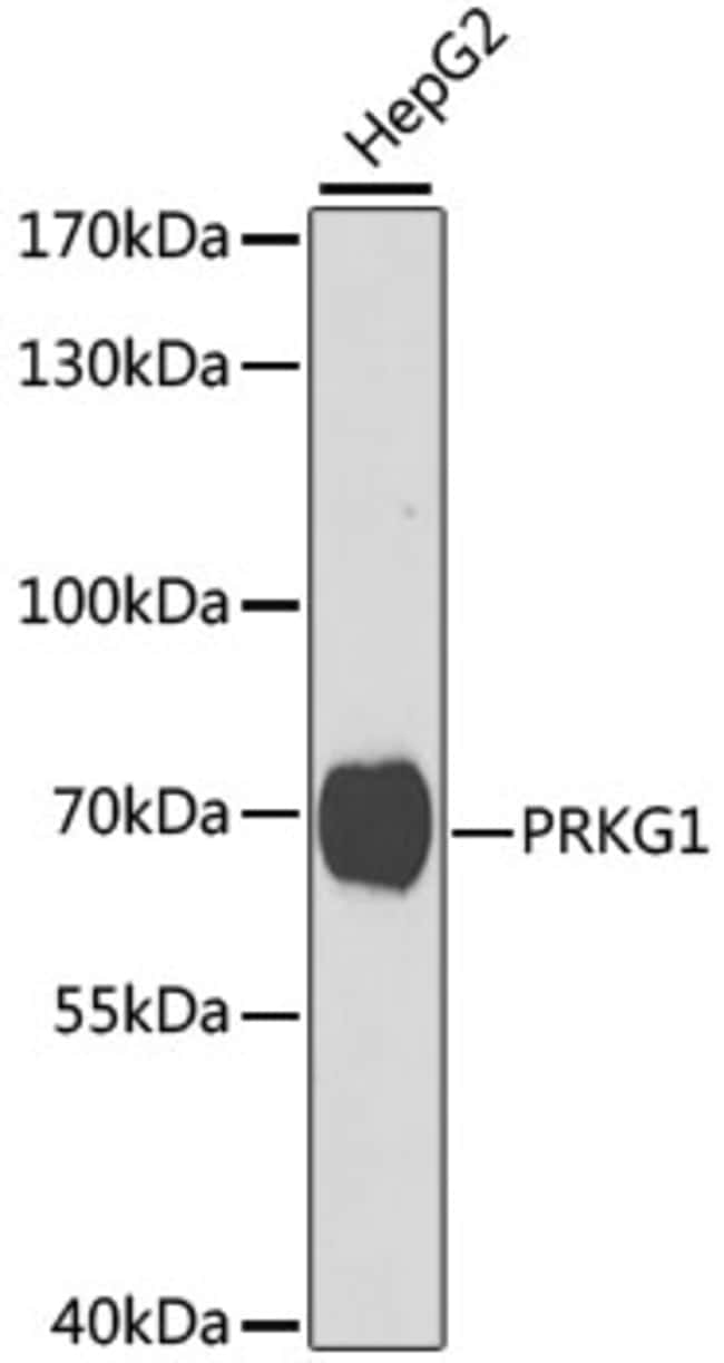 100UL CGKI ANTIBODY 100 ul