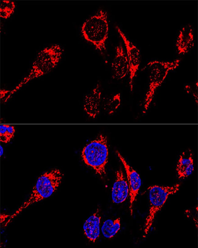 100UL AIF ANTIBODY 100 ul