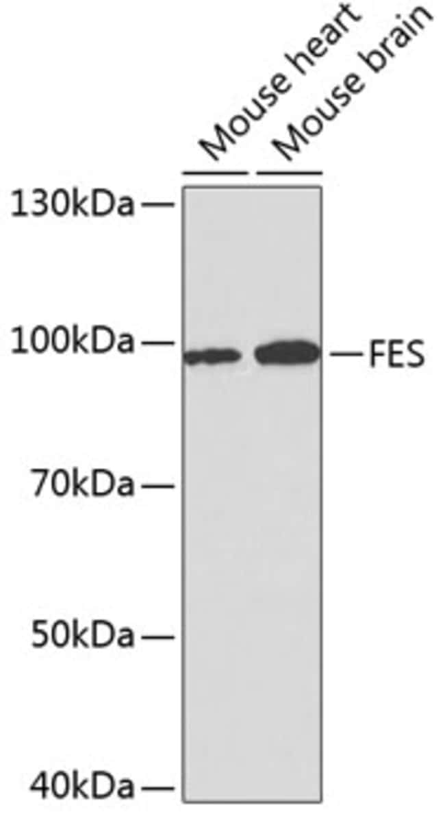 100UL FES ANTIBODY 100 ul
