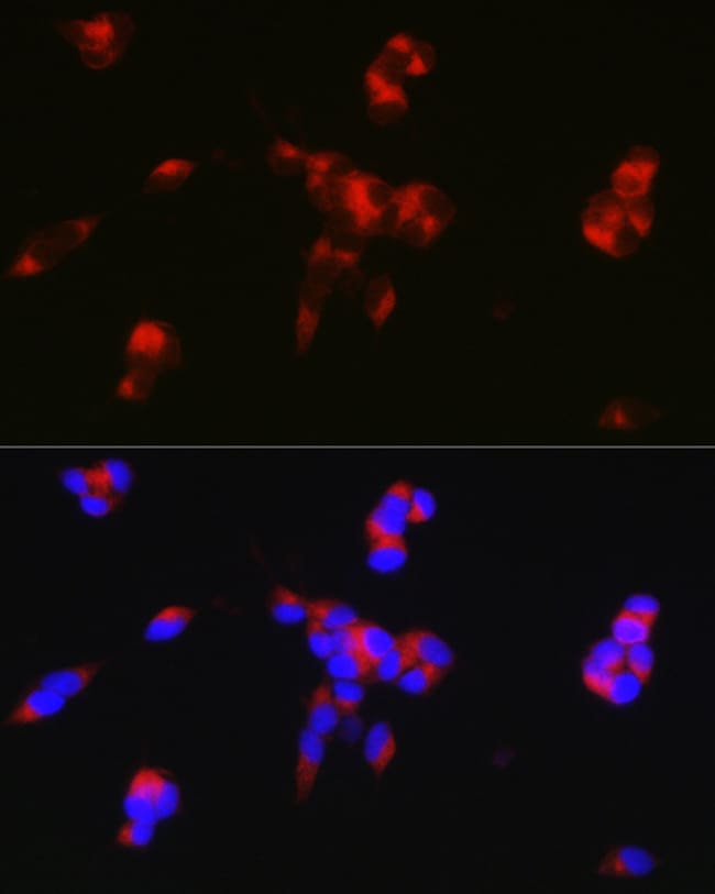 100UL DARPP-32 ANTIBODY 100 ul