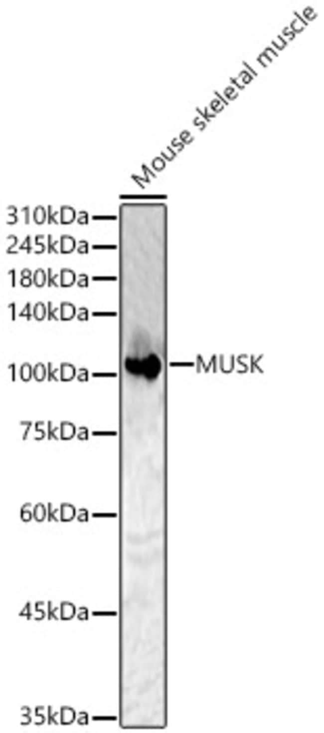 100UL MUSK ANTIBODY 100 ul