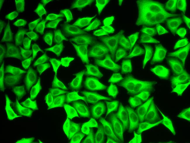 100UL ALDH4A1 ANTIBODY 100 ul